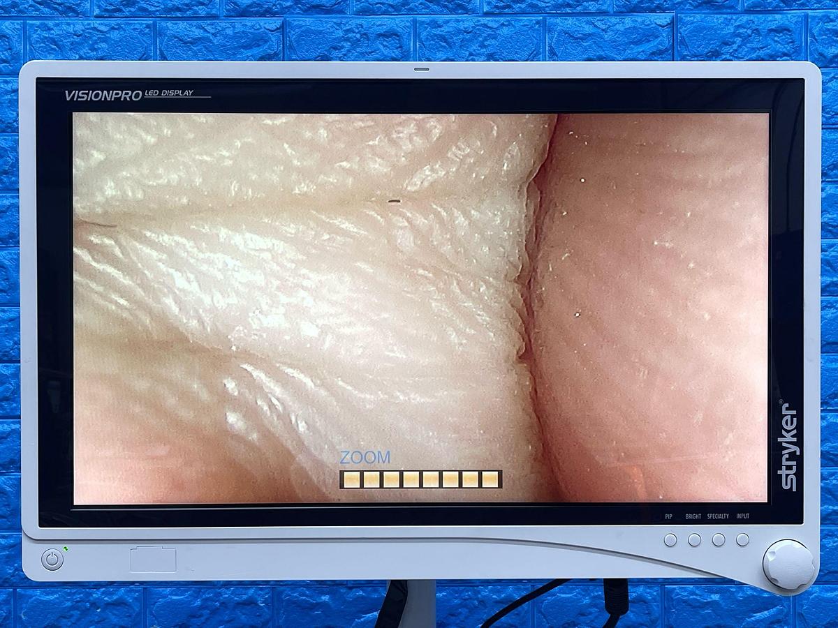 Used Stryker 1488 Tower  Lcd Monitor  YOM: 2017