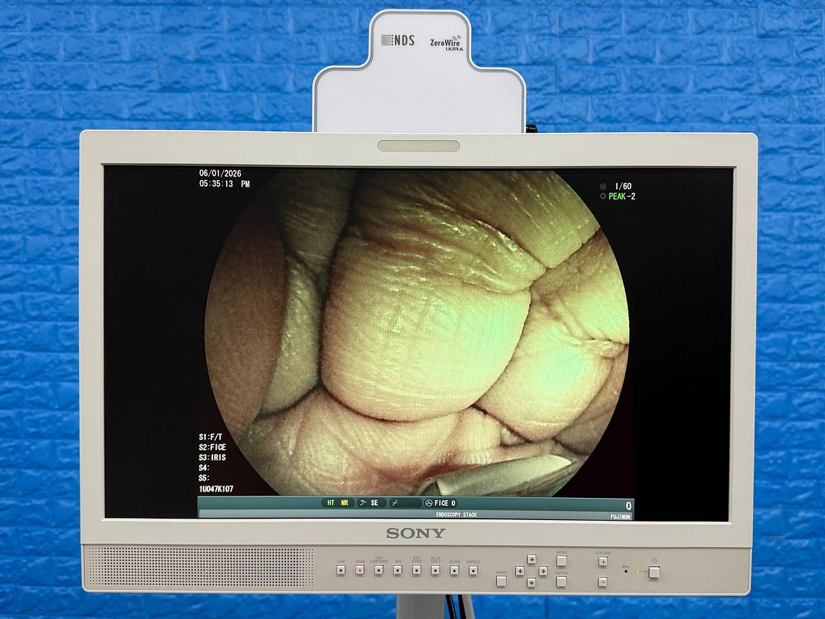 Used Fujinon Scope EG-580 UT Linear Ultrasonic Endoscope 