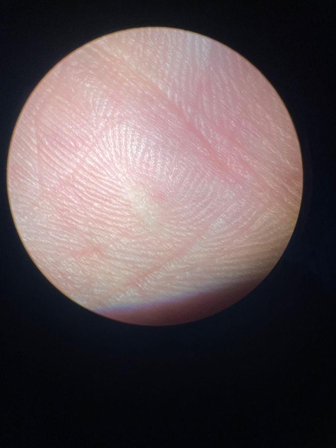 Used ZEISS S8 OPMI VISU 150 Microscope  