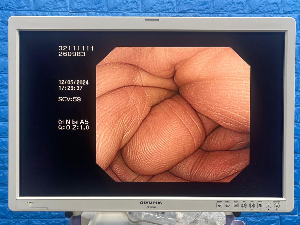 Used  Olympus scope  Model: CF-H260DL 