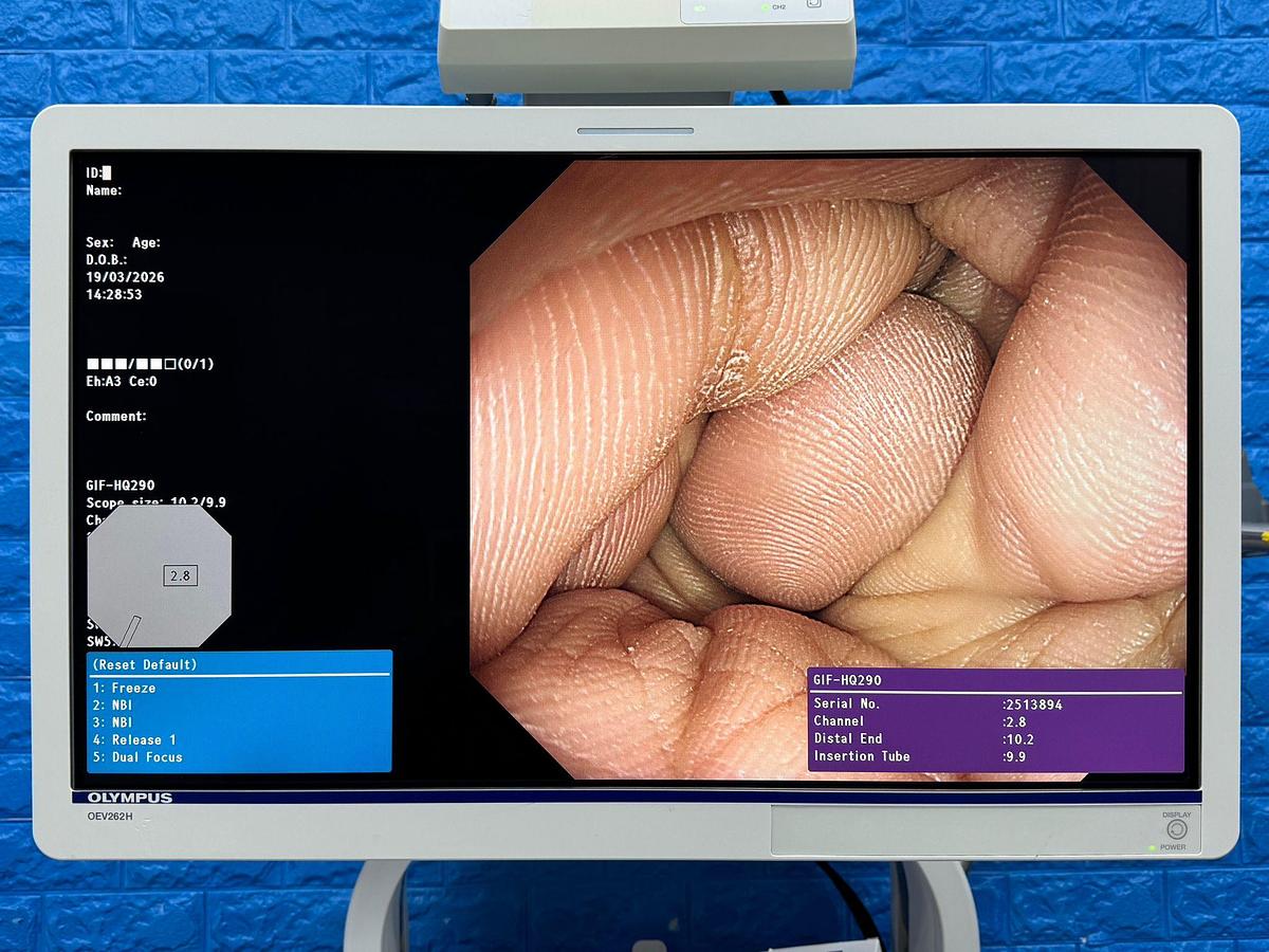 Used Olympus Scope  Model: GIF-HQ290 