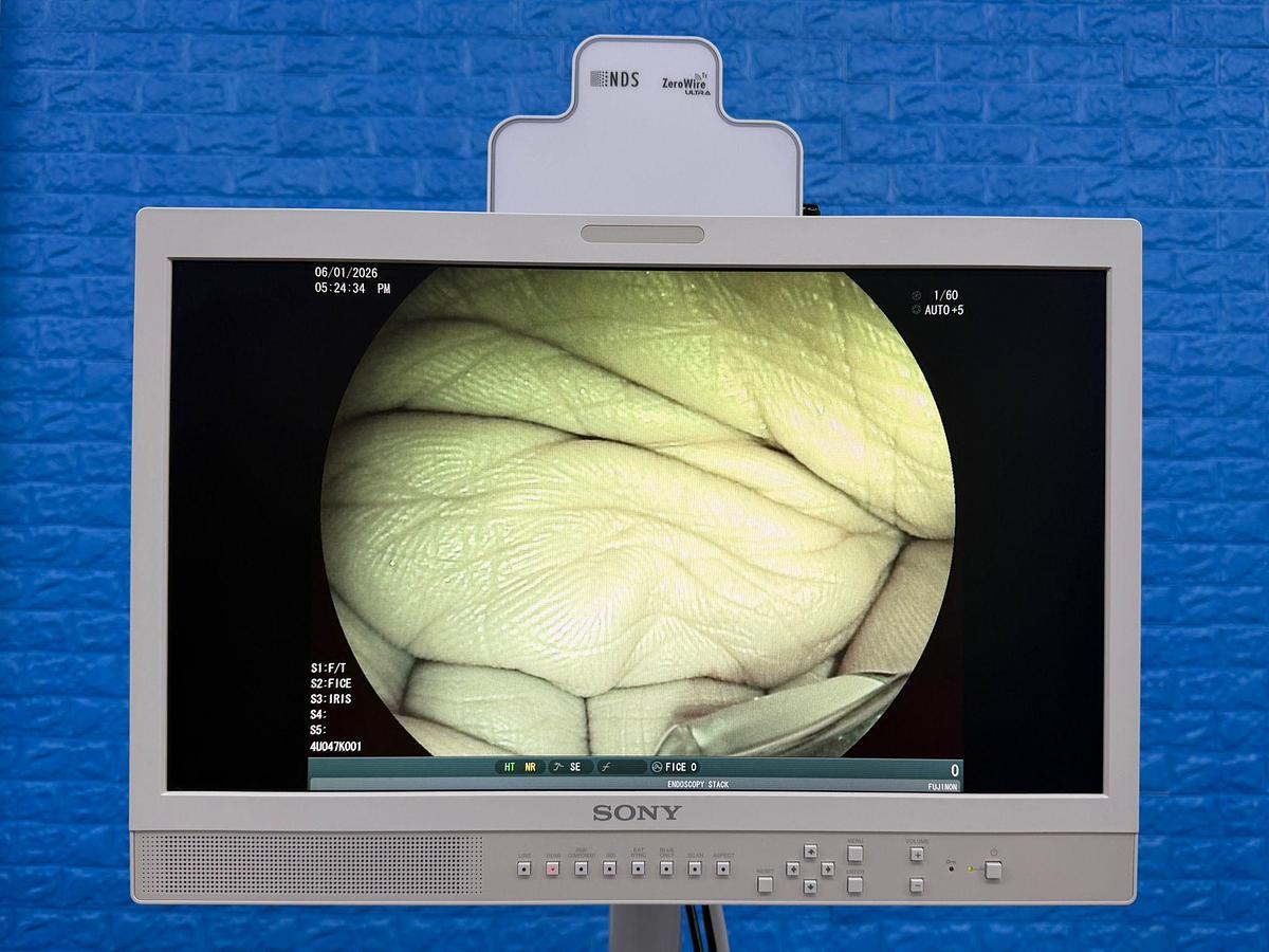 Used Fujinon Scope EG-580 UT Linear Ultrasonic Endoscope YOM: 2018 