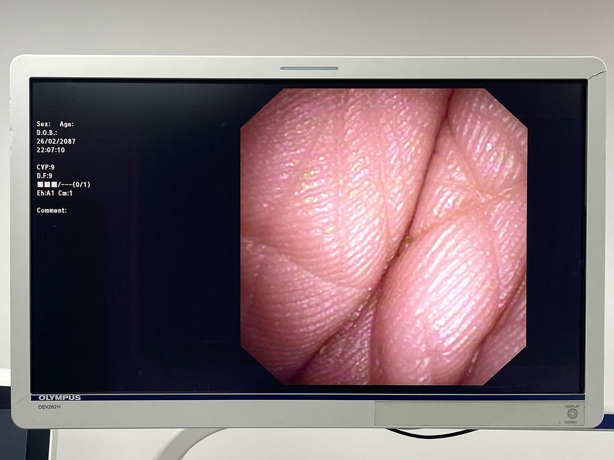 Used Olympus Scope Model: CYF-VA