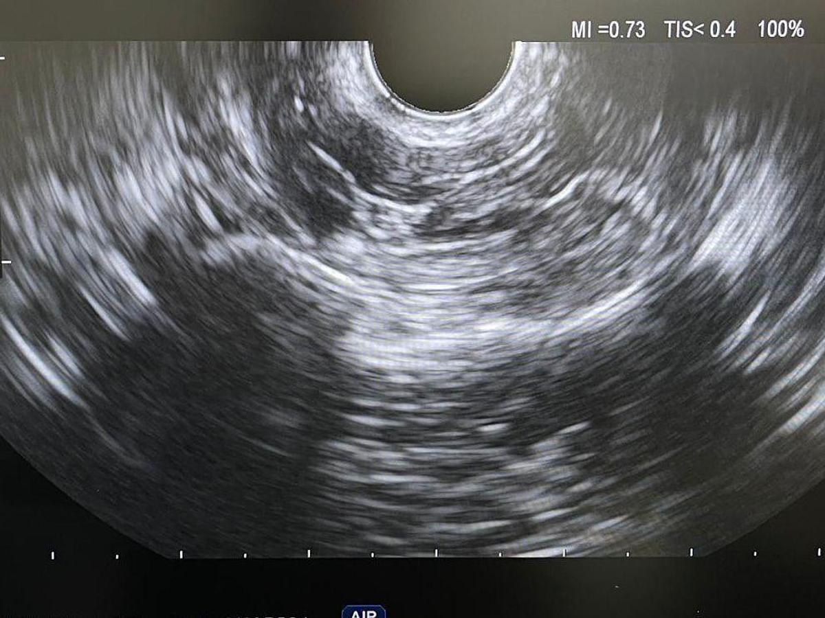 Used OLYMPUS EU-ME1 - Power Input Voltage: 110 Endoscopy Ultrasound Processor