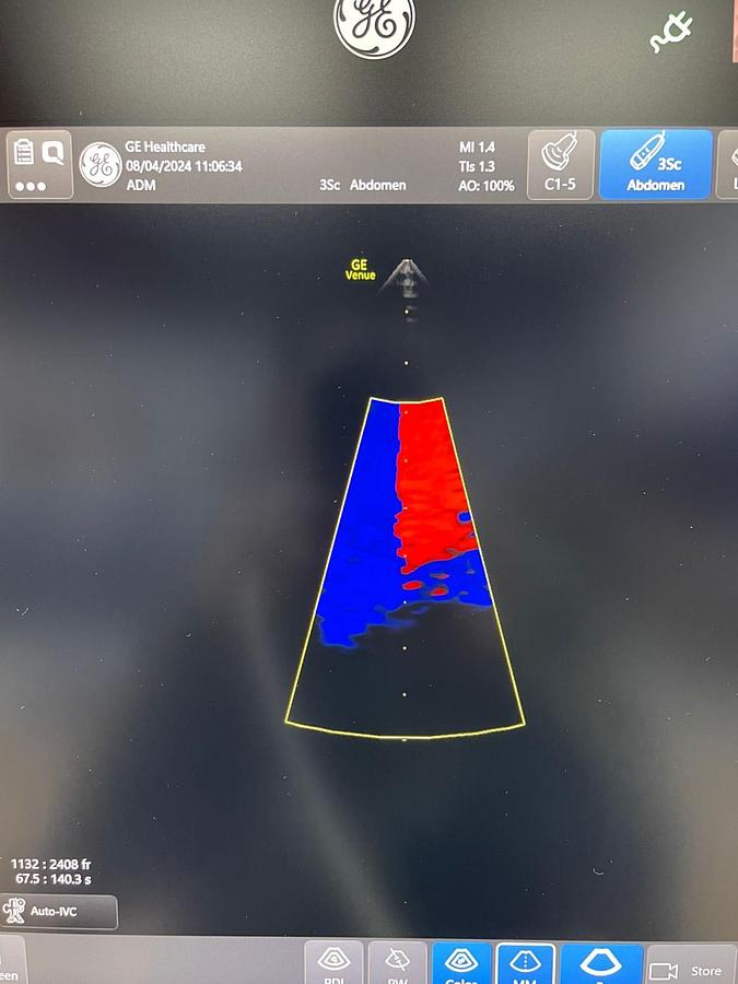 Used GE Venue YOM: 2018 With 3 Probes.