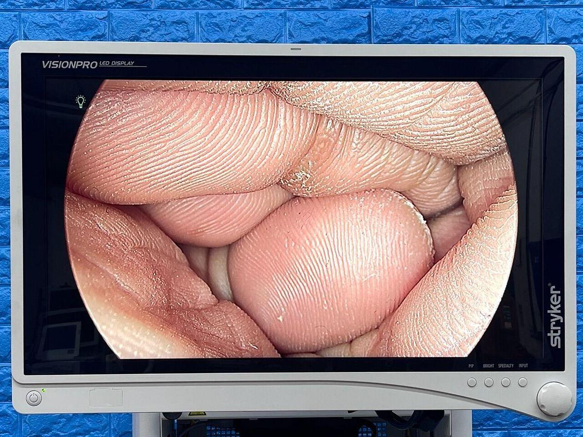 Used STRYKER 1588 Tower Lcd Monitor YOM