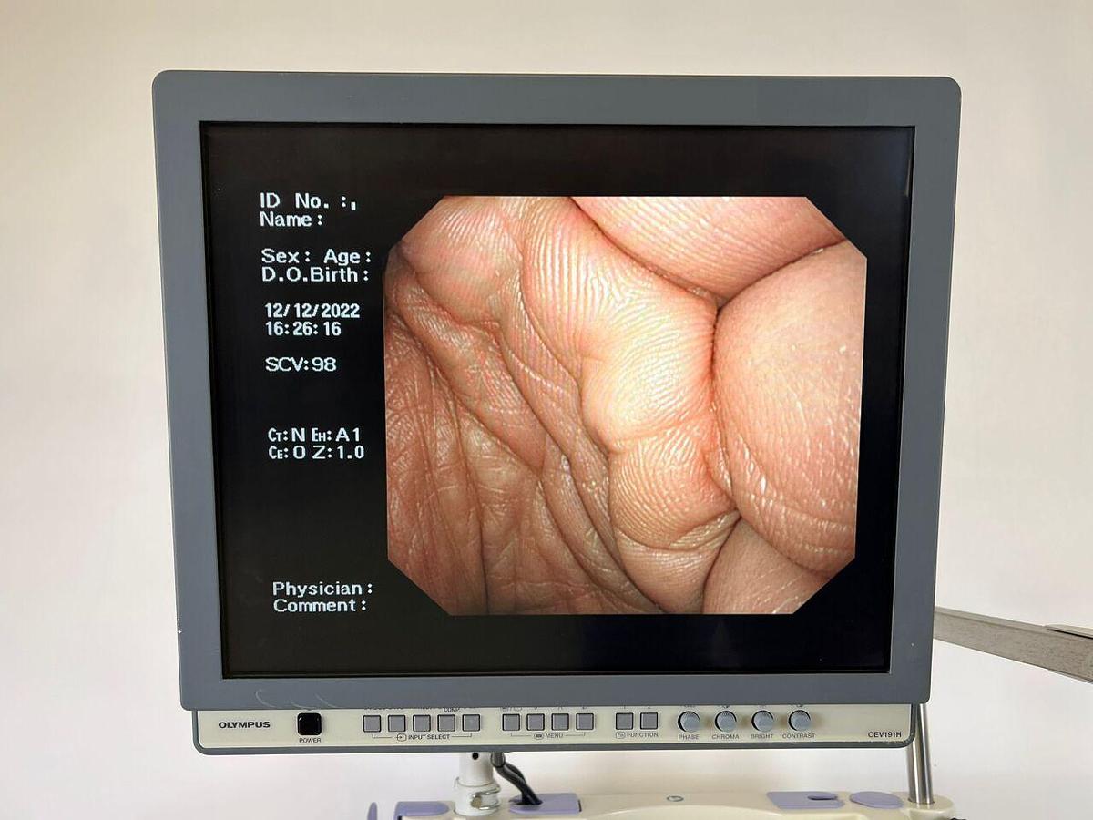 Used OLYMPUS CV-260SL complete Tower with GIF-H260 Gastro and CF-Q260DL Long Colonoscope Endoscope