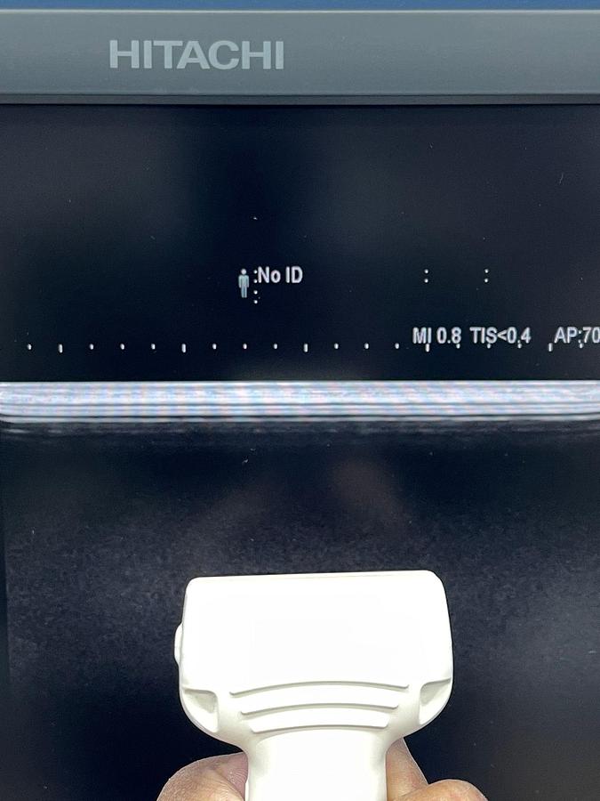 Used Hitachi Aloka Arietta V70 Ultrasound  YOM: 2016 With 5x Probes