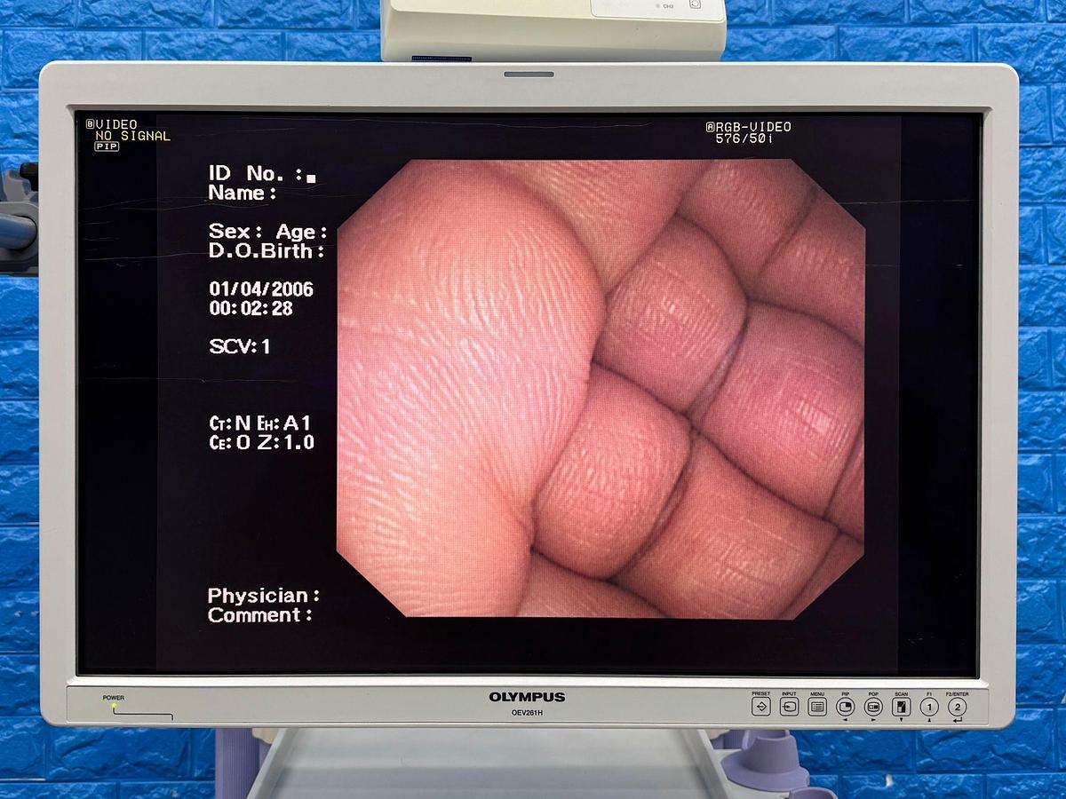 Used Olympus Scope Model: CF-Q260DL 