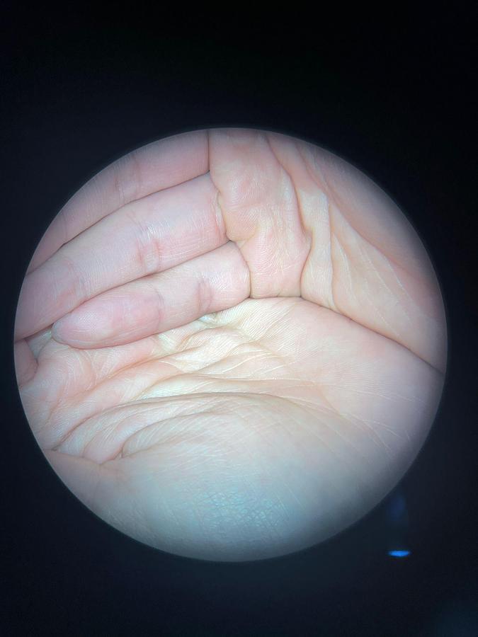 Used ZEISS Stativ S88 OPMI VARIO Microscope