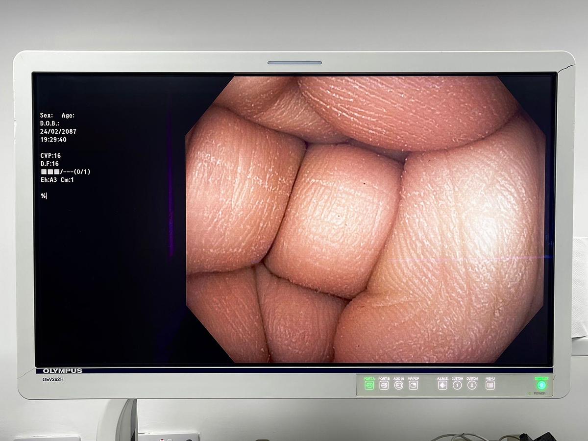 Used Olympus PCF-H190DL Colonoscope