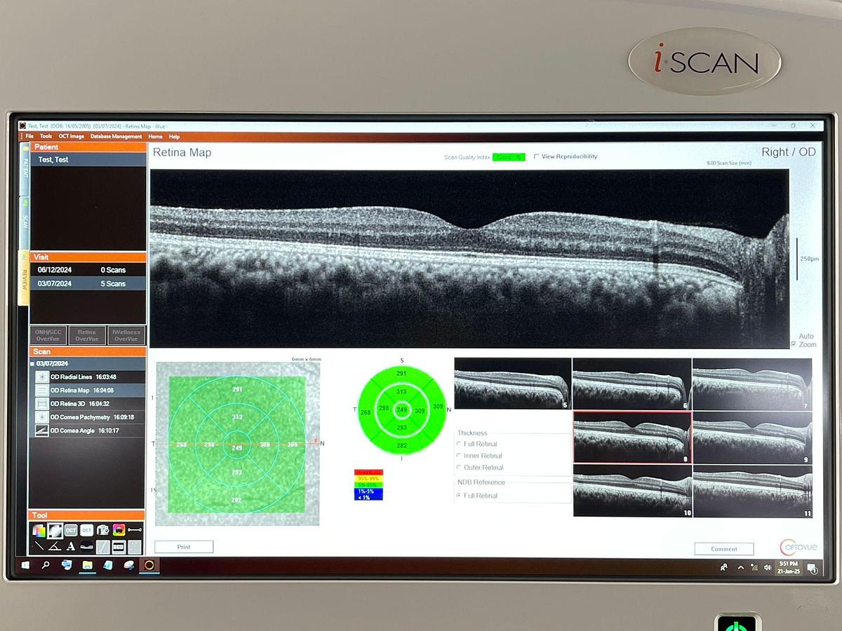 Used OPTOVUE IVUE 500 YOM: 2021 OCT