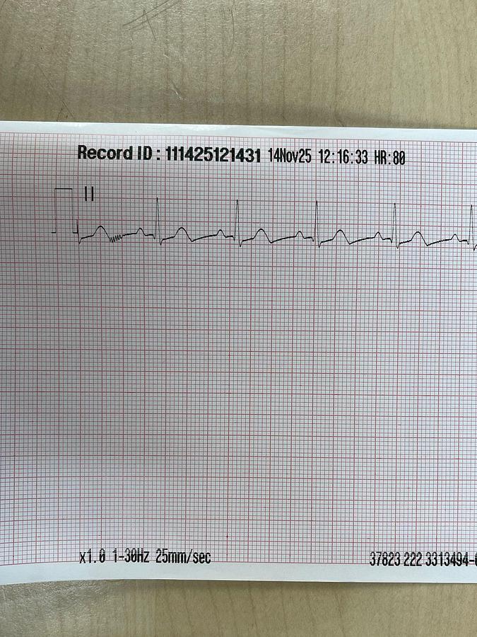 Used Physio Control Lifepak 15 Monitor YOM: 2018