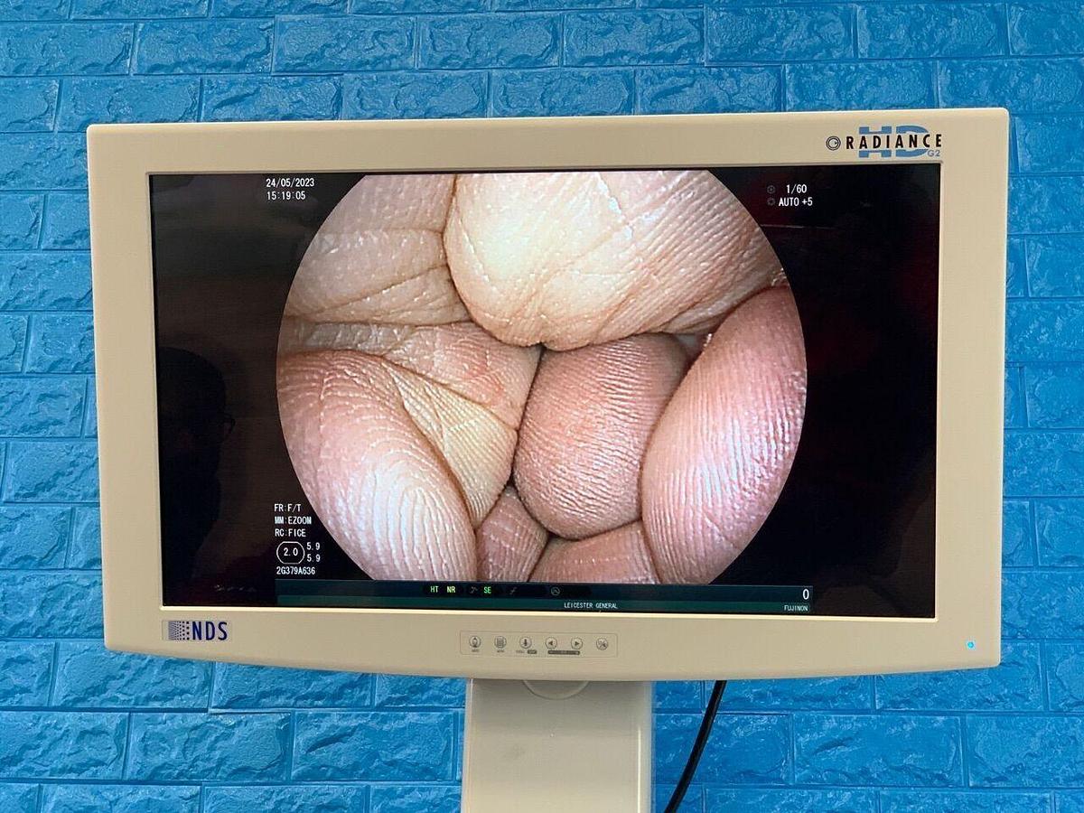 Used FUJINON EG-580NW