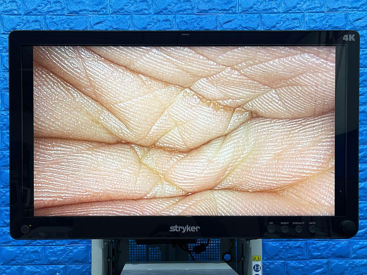 Used Stryker 1688 4K Tower  Lcd Monitor 4k 32” YOM: 2021