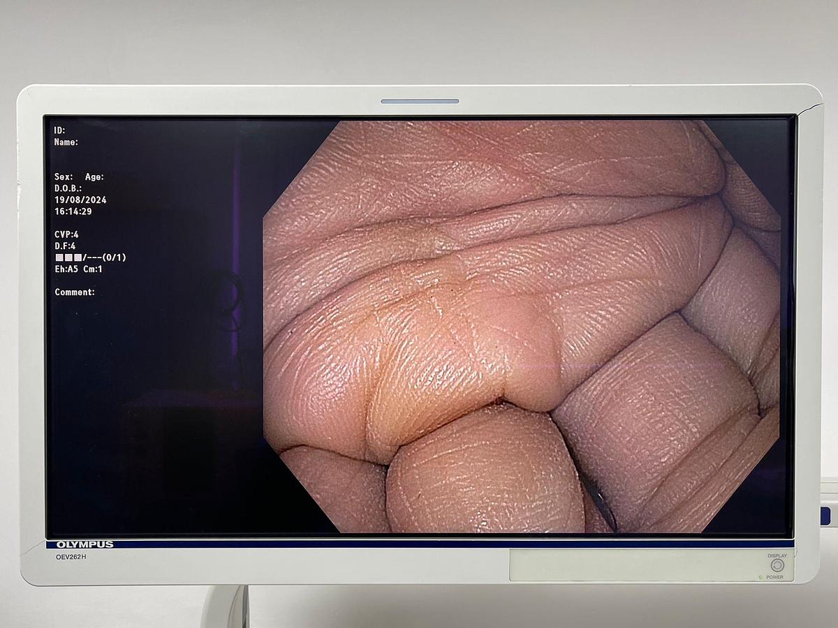 Used Olympus Scope Model: GIF- HQ190