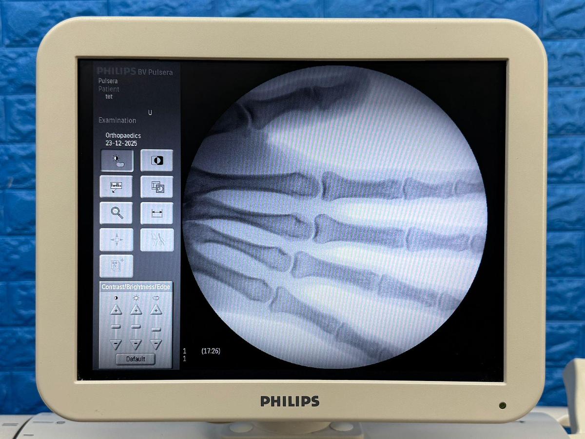 Used Philips BV PULSERA YOM: 2015 