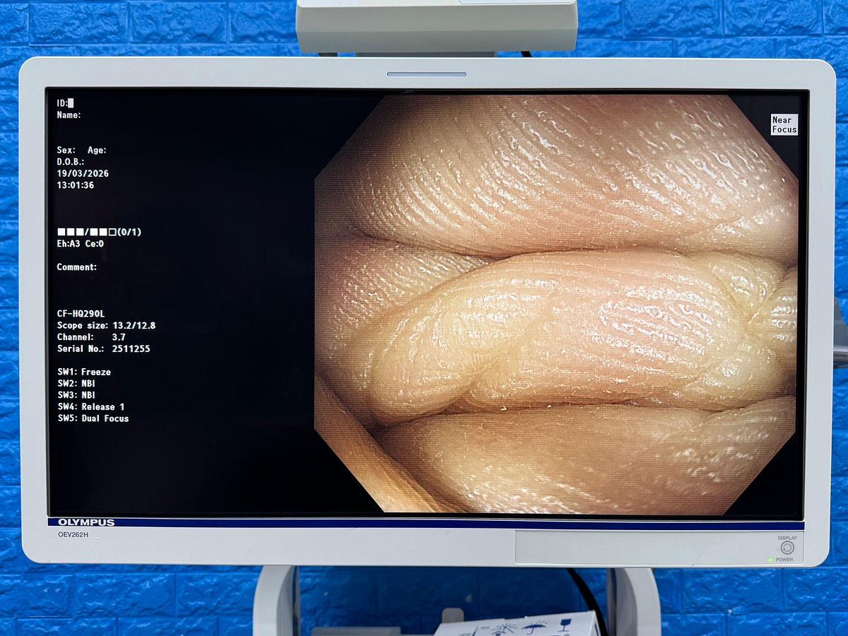 Used  Olympus Scope  Model: CF-HQ290L