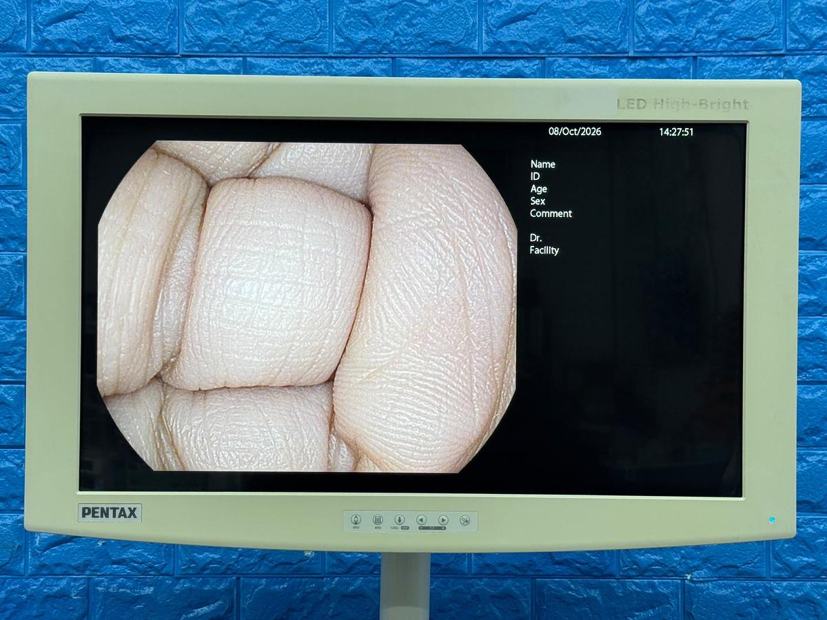 Used Pentax EPK-i7000 Complete Endoscopy Tower with Gastroscope & Colonoscope YOM 2013
