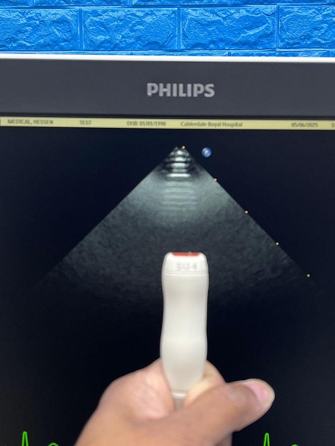 Used PHILIPS EPIQ 7C Ultrasound SW: HW B.0 YOM: 2018 Cardiac – Vascular Ultrasound