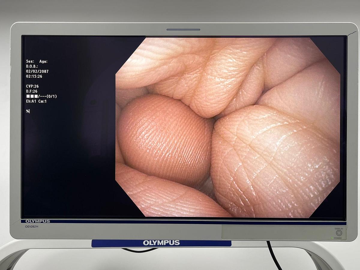 Used Olympus Scope Model: GIF-H190N