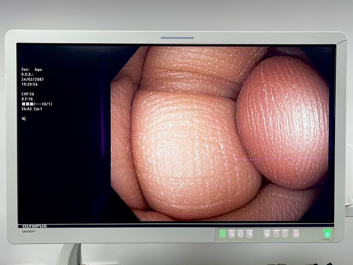 Used Olympus PCF-H190DL Colonoscope