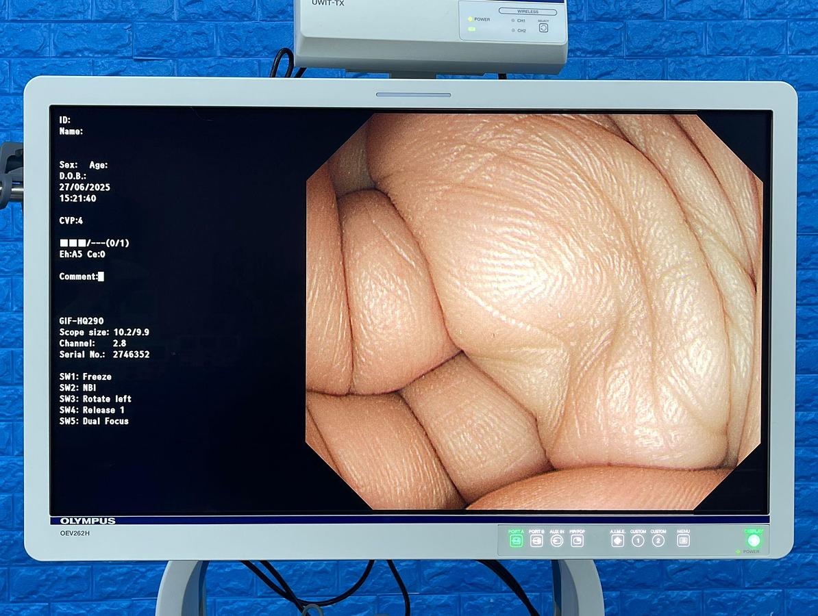 Used Olympus GIF-HQ290 Gastroscope