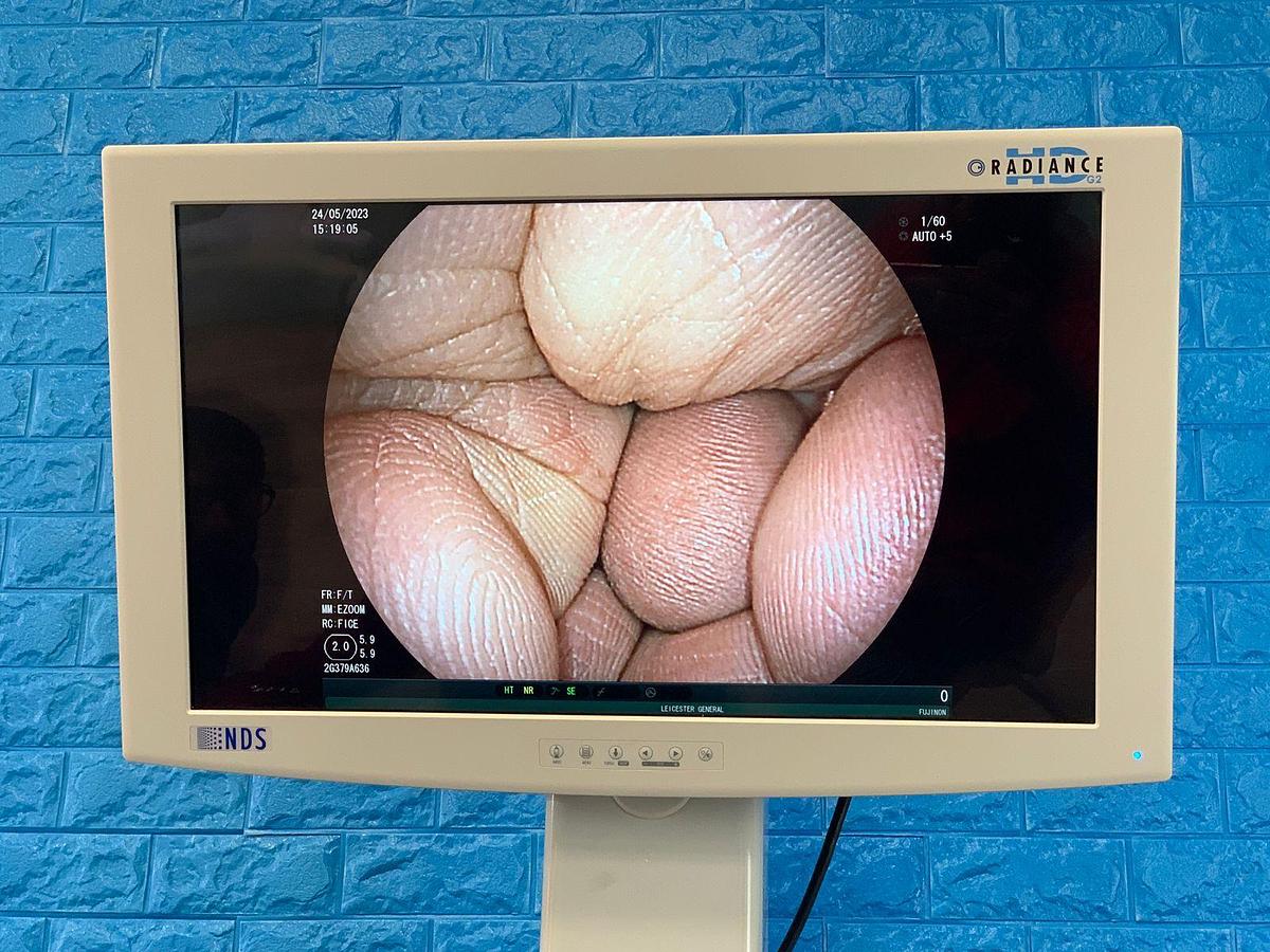 Used FUJINON EG-580NW