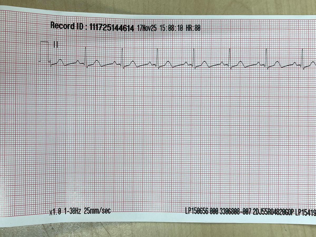 Used Physio Control Lifepak 15 Monitor, YOM: 2013 Defibrillator