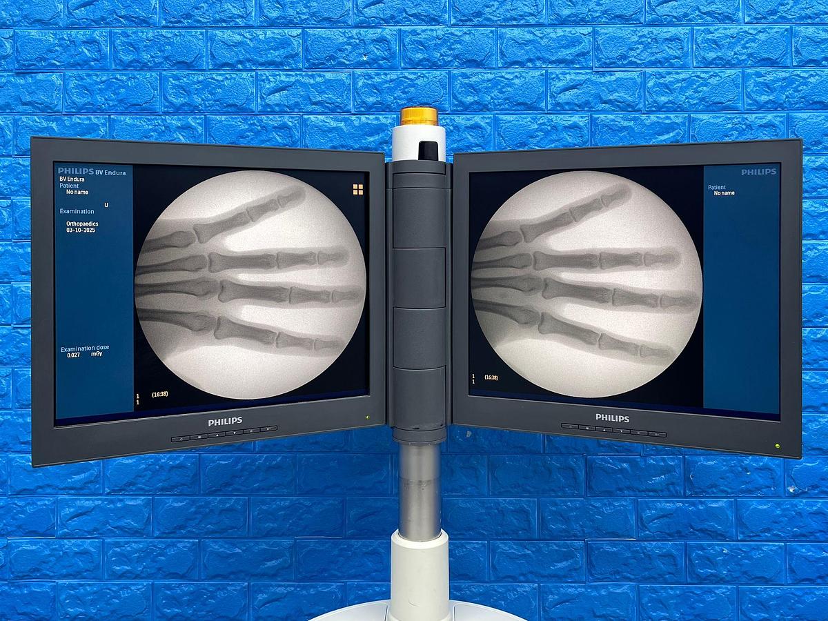 Used  PHILIPS BV Endura C-Arm YOM: 2012