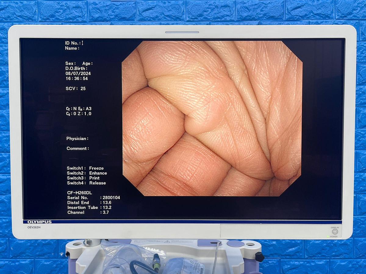 Used OLYMPUS Endoscopy Tower 260, CV-260SL Endoscope 