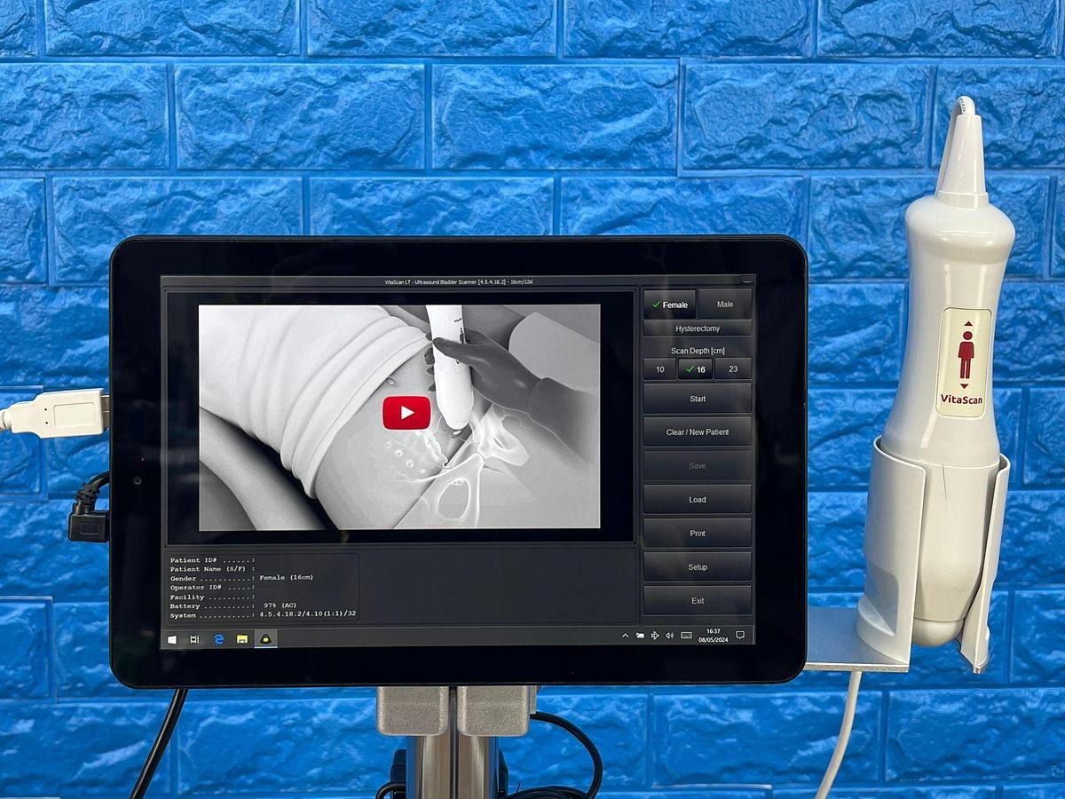 Used Vitacon VitaScan LT Urology Ultrasound With Vitascan V2 Probe.