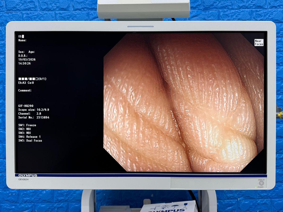 Used Olympus Scope  Model: GIF-HQ290 