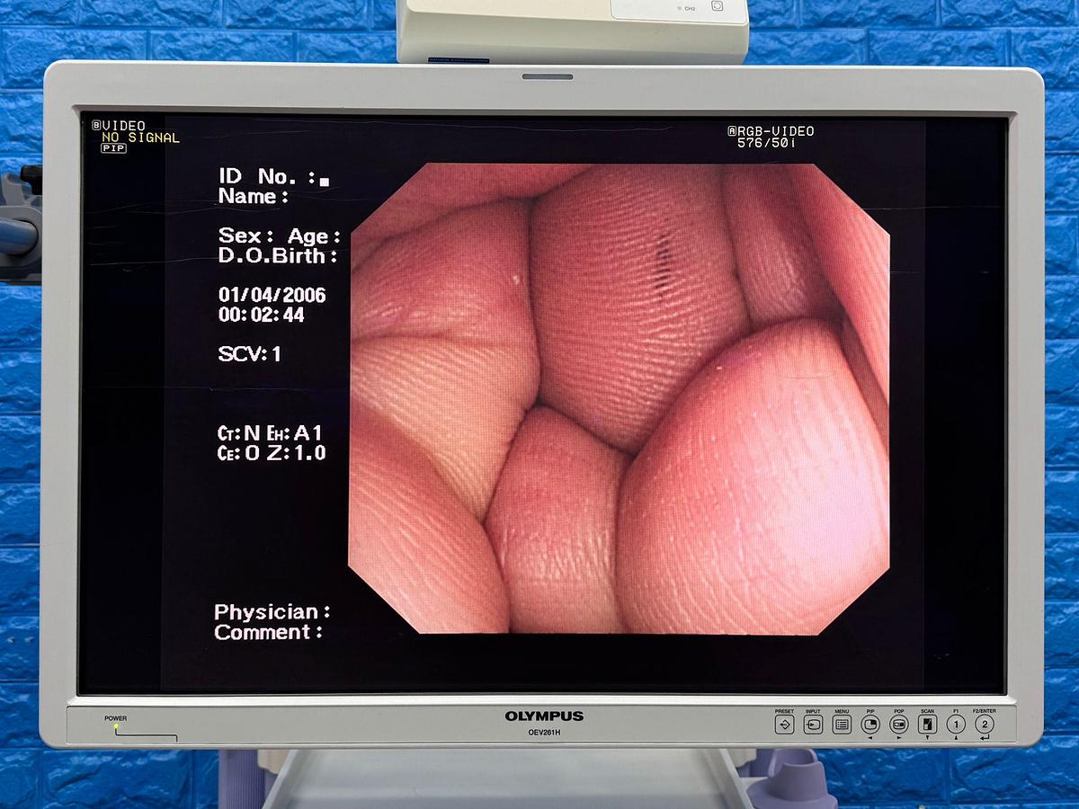 Used Olympus Scope Model: CF-Q260DL 