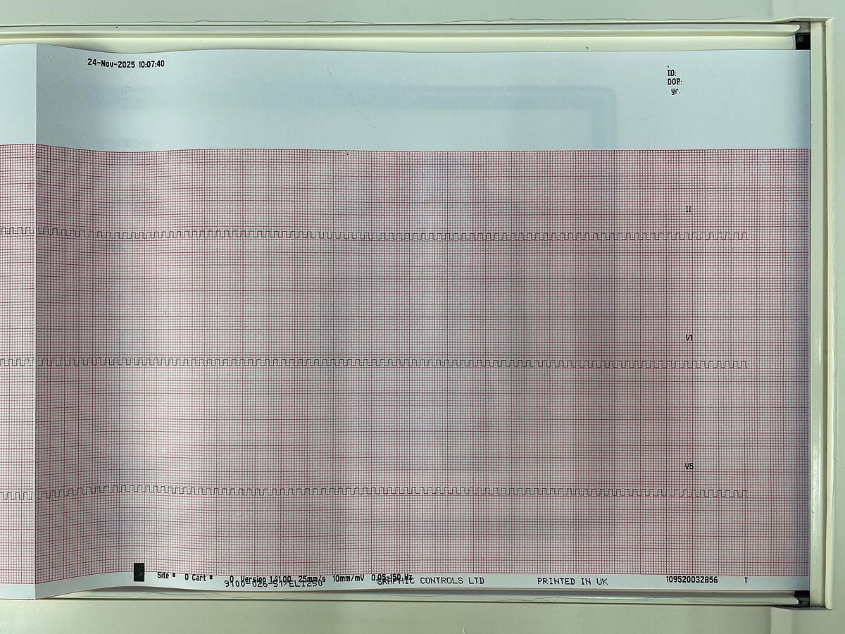 Used Mortara Insturment ELI 250 ECG REF: ELI250-BAD-AAAAX