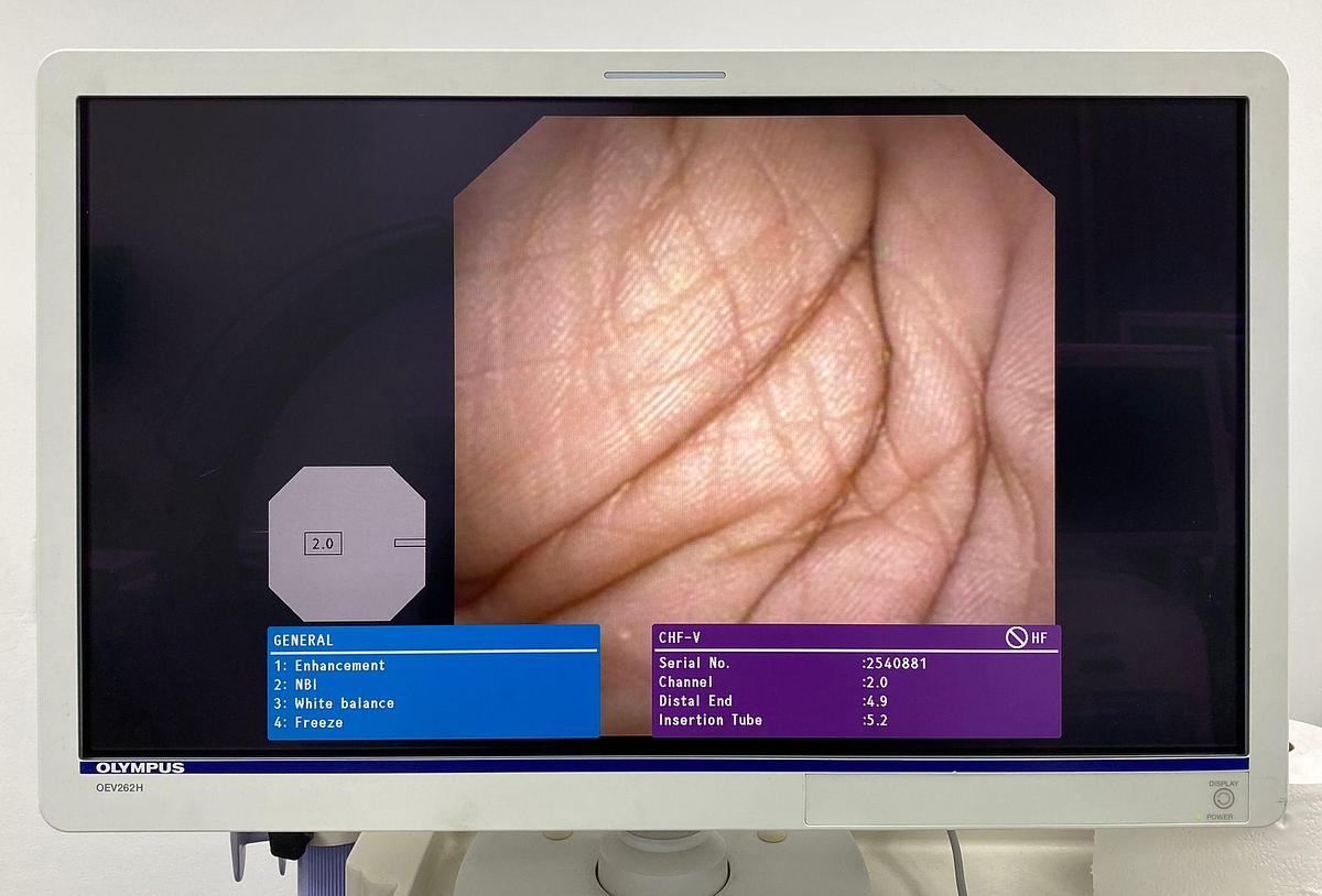 Used OLYMPUS CHF-V Choledochoscope