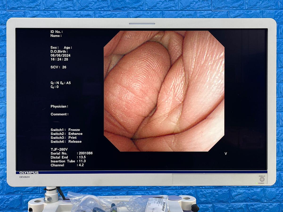 Used Olympus TJF 260V Duodenoscope