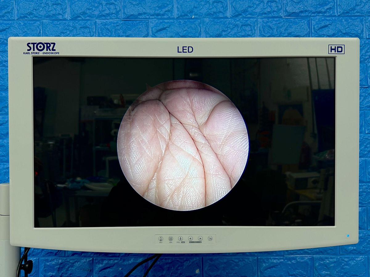 Used Stryker 4 mm 30° Ideal Eyes HD Autoclavable Arthroscope Optic REF: 0502-104-030