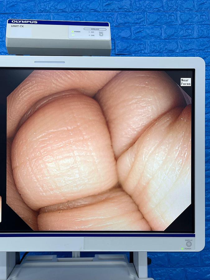 Used Olympus scope Model: GIF-HQ290