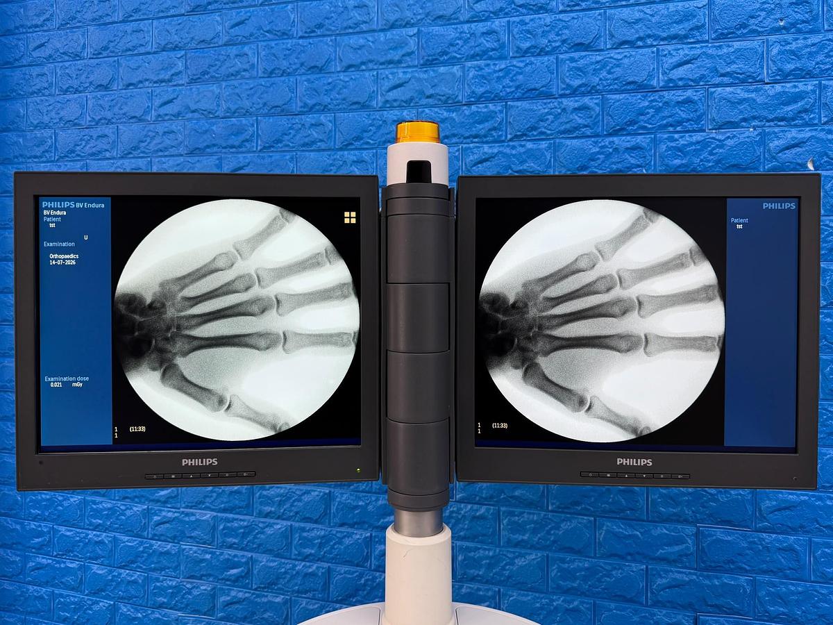 Used Philips BV Endura Software 2.5.5 YOM: 2016   Options: Abdominal Thorax  Lumbar Spine  Head / Spine Orthopaedics