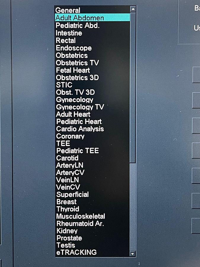 Used Hitachi Aloka Arietta V70 Ultrasound  YOM: 2016 With 5x Probes
