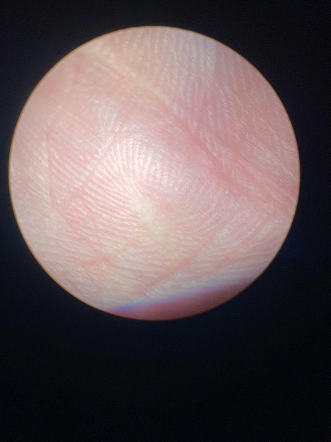 Used ZEISS S8 OPMI VISU 150 Microscope  