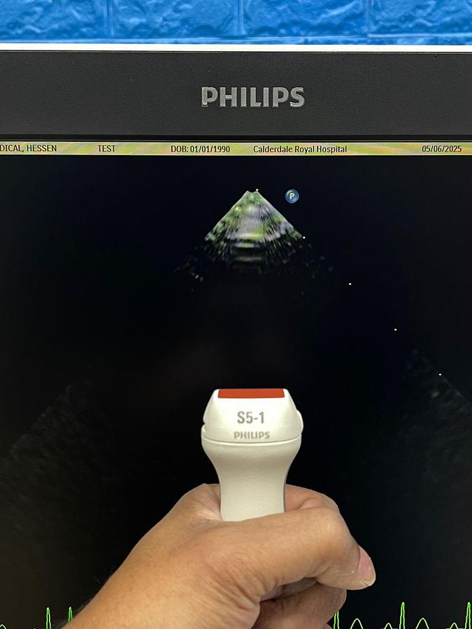 Used PHILIPS EPIQ 7C Ultrasound SW: HW B.0 YOM: 2018 Cardiac – Vascular Ultrasound