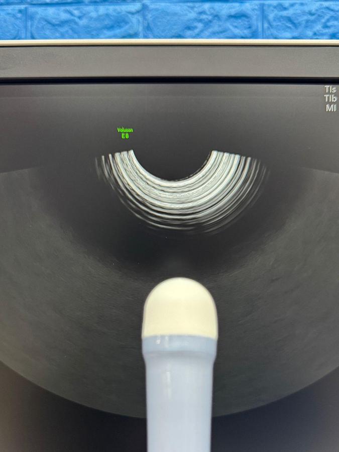 Used GE Voluson E8 Ultrasound YOM: 2020