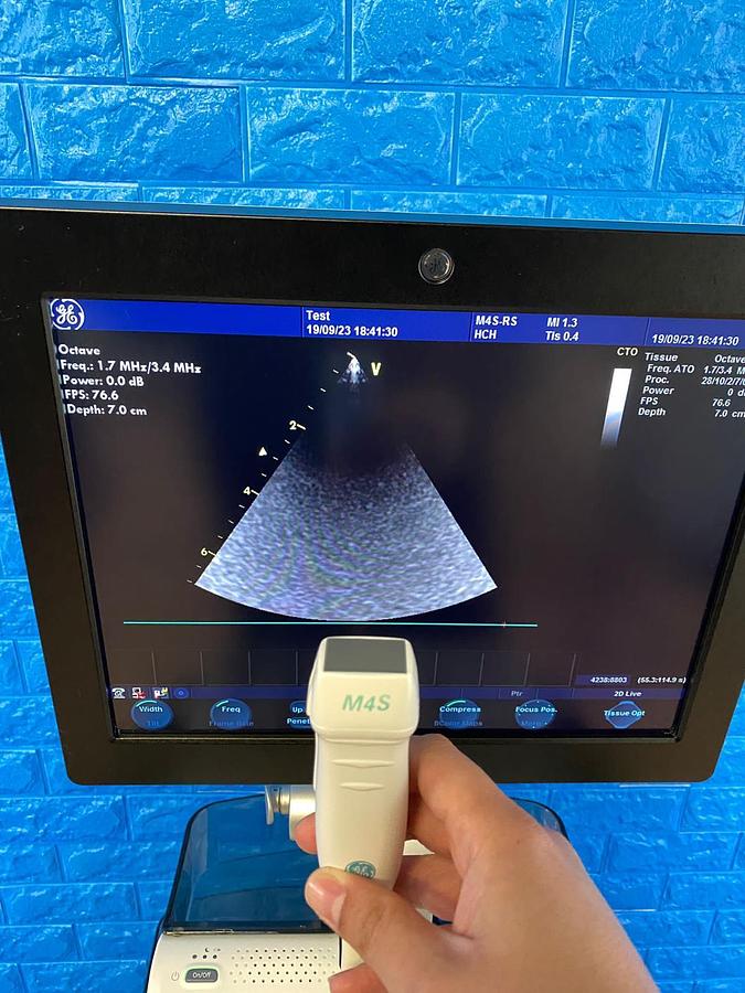 Used GE Vivid S6 Cardiovascular ultrasound system YOM: 2013