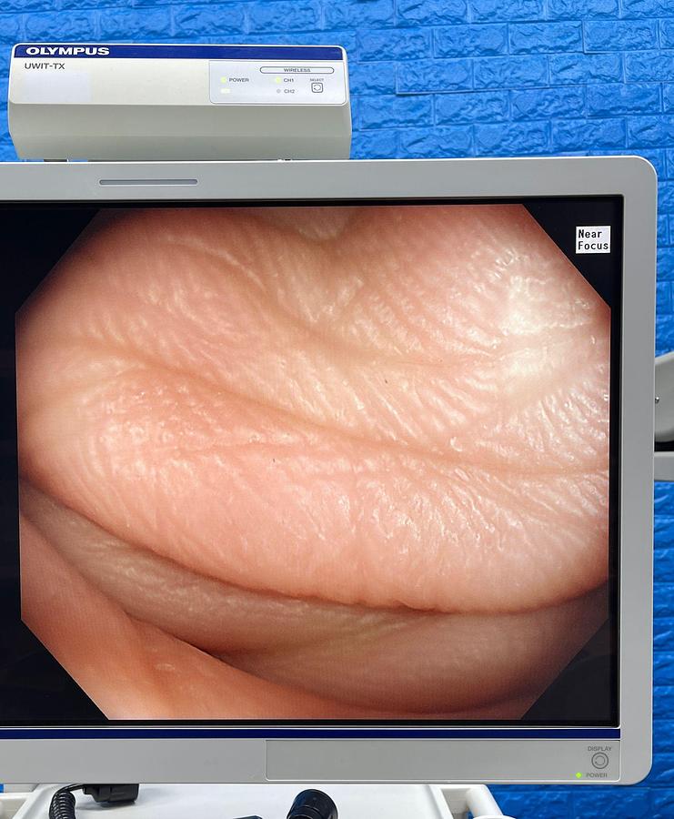 Used Olympus CF-HQ290L Colonoscope