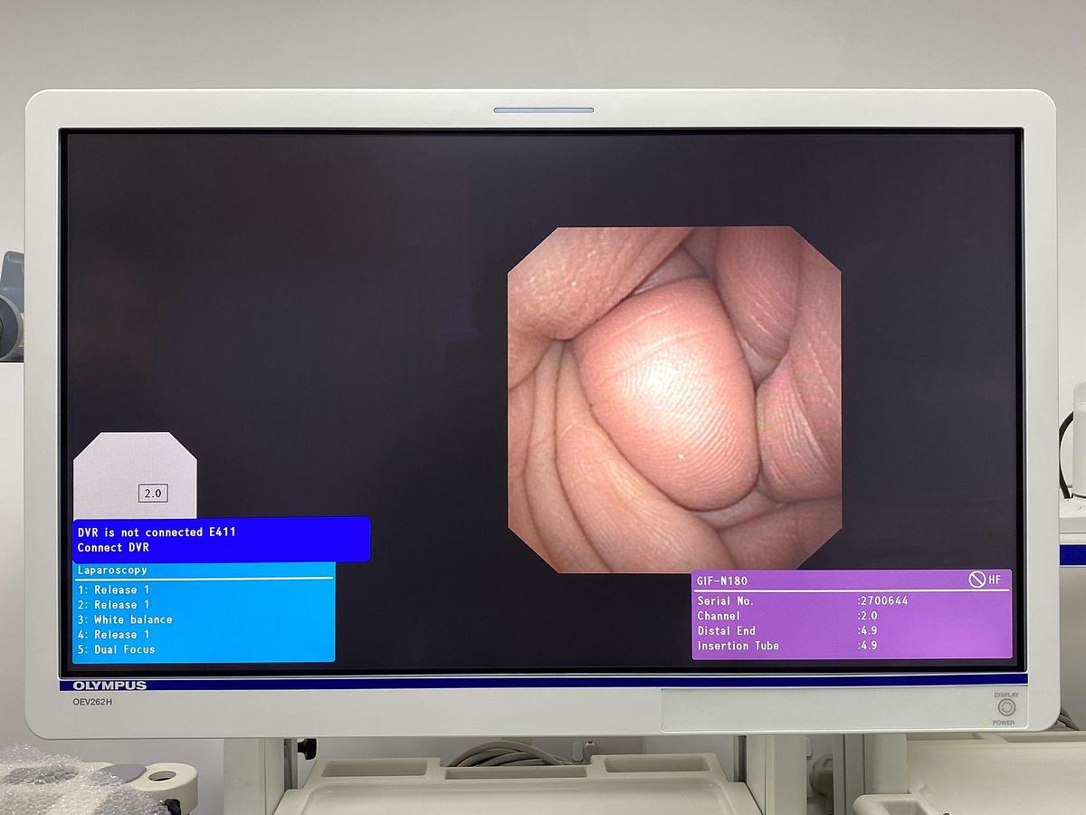 Used Olympus scope Mode: GIF-N180