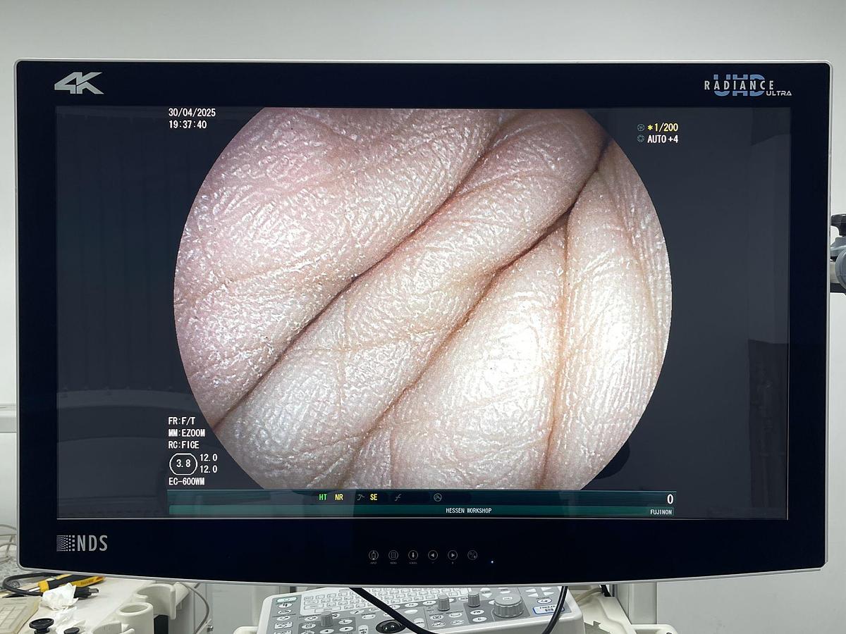 Used FUJINON Scope Model: EC-600WM Colonoscope