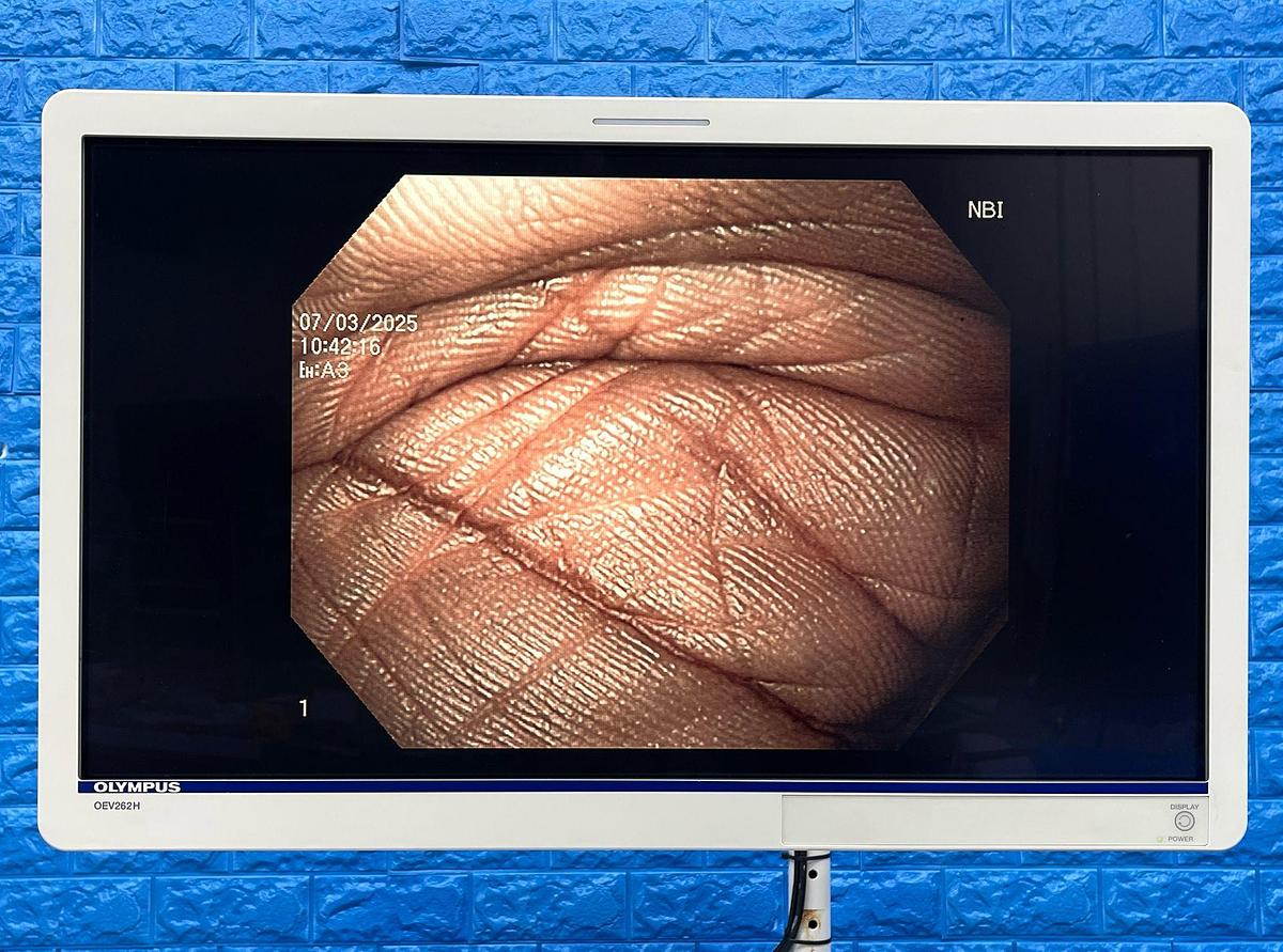 Used Olympus Scope Model: GIF-H180J