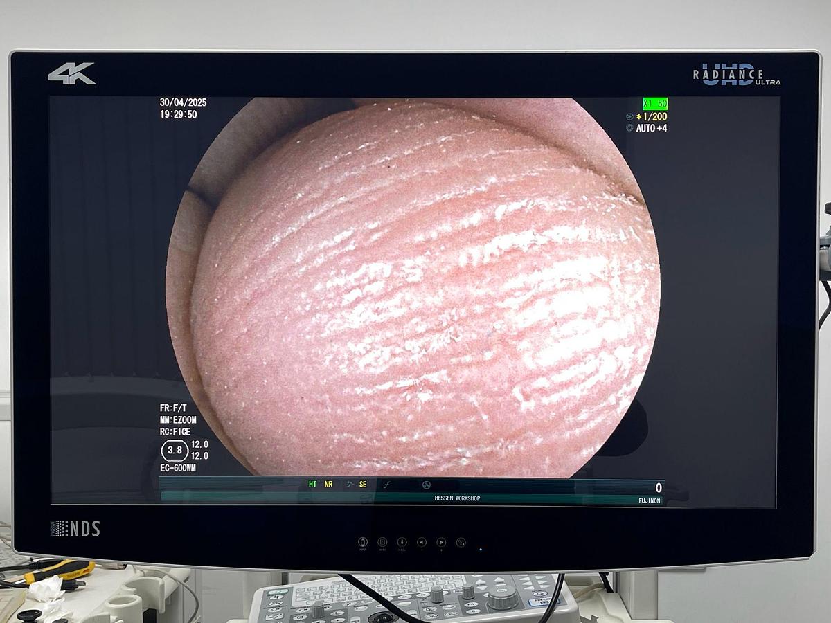 Used FUJINON Scope Model: EC-600WM Colonoscope Colonoscope